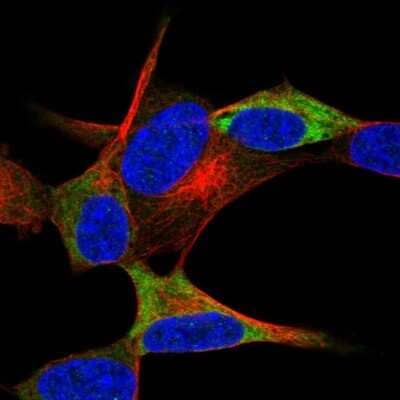 Immunocytochemistry/ Immunofluorescence: NACAD Antibody [NBP2-47363]