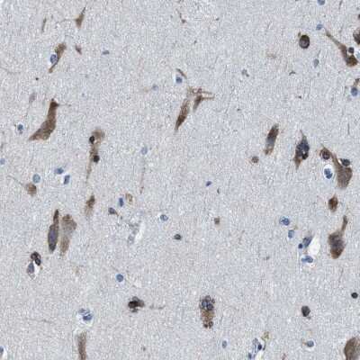 Immunohistochemistry-Paraffin: NACAD Antibody [NBP2-47363]