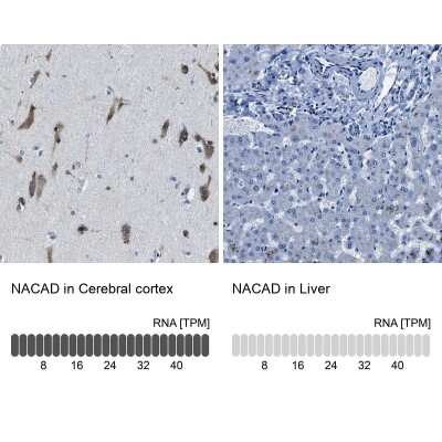 Immunohistochemistry-Paraffin: NACAD Antibody [NBP2-47363]