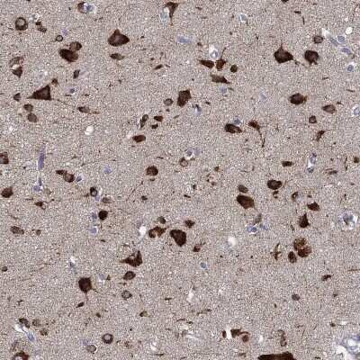 Immunohistochemistry-Paraffin: NACAD Antibody [NBP3-17129]