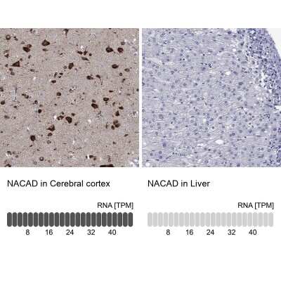 Immunohistochemistry-Paraffin: NACAD Antibody [NBP3-17129]