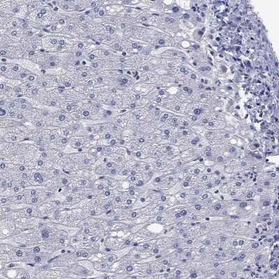 Immunohistochemistry-Paraffin: NACAD Antibody [NBP3-17129]