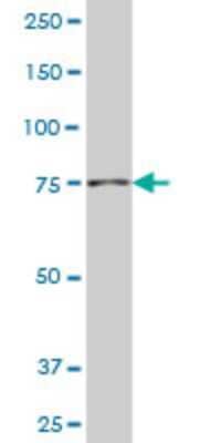 Western Blot: NAD Synthetase Antibody (4G9) [H00055191-M01]