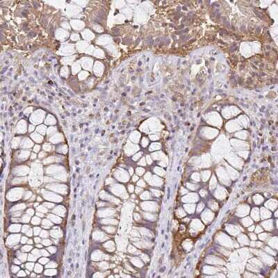 Immunohistochemistry-Paraffin: NAD Synthetase Antibody [NBP2-58372]