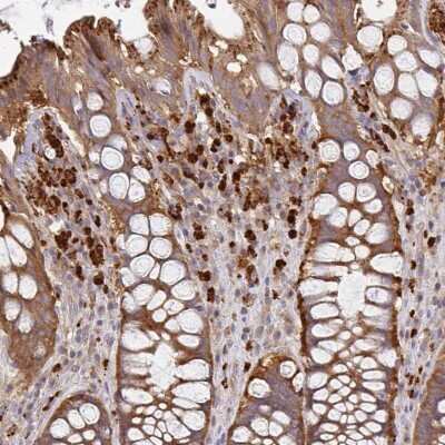 Immunohistochemistry-Paraffin: NAD Synthetase Antibody [NBP2-58373]