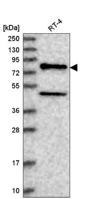 Western Blot: NAD Synthetase Antibody [NBP2-58372]