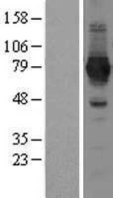 Western Blot: NAD Synthetase Overexpression Lysate [NBL1-13457]