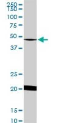 Western Blot: NADK Antibody (5F4) [H00065220-M01]