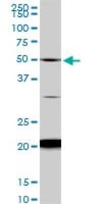 Western Blot: NADK Antibody (5F4) [H00065220-M01]