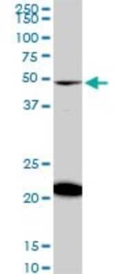 Western Blot: NADK Antibody (5F4) [H00065220-M01]