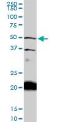 Western Blot: NADK Antibody (5F4) [H00065220-M01]