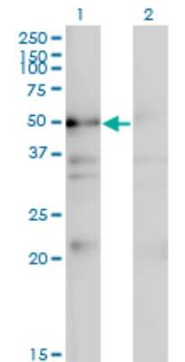 Western Blot: NADK Antibody (5F4) [H00065220-M01]