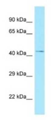 Western Blot: NADK Antibody [NBP1-98562]