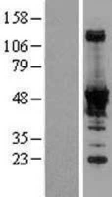 Western Blot: NADK Overexpression Lysate [NBL1-13456]