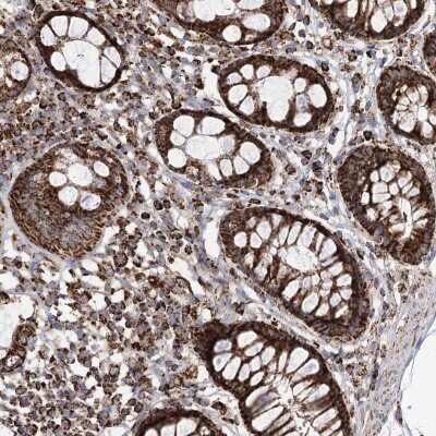 Immunohistochemistry: NADKD1 Antibody [NBP2-48680]