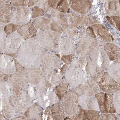 Immunohistochemistry-Paraffin: NADKD1 Antibody [NBP1-83547]