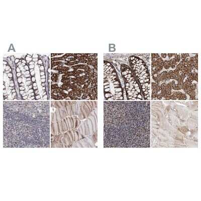 Immunohistochemistry-Paraffin: NADKD1 Antibody [NBP1-83547]