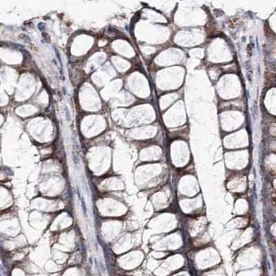 Immunohistochemistry-Paraffin: NADKD1 Antibody [NBP1-83547]