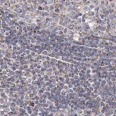 Immunohistochemistry-Paraffin: NADKD1 Antibody [NBP1-83547]