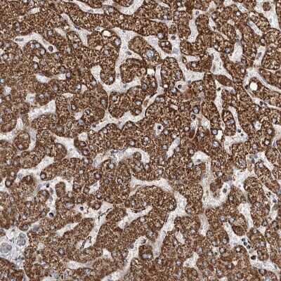 Immunohistochemistry-Paraffin: NADKD1 Antibody [NBP2-48680]