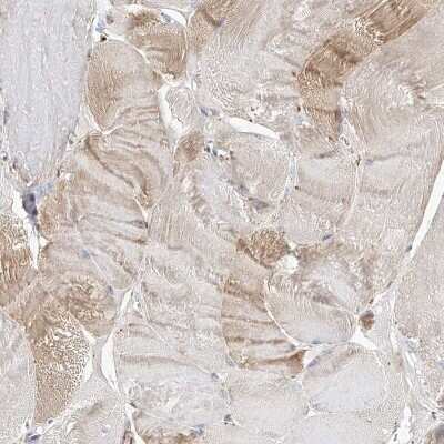 Immunohistochemistry-Paraffin: NADKD1 Antibody [NBP2-48680]