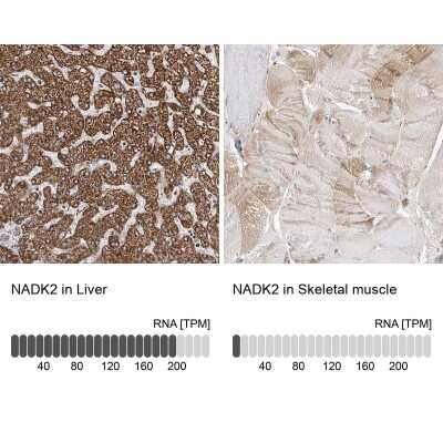 Immunohistochemistry-Paraffin: NADKD1 Antibody [NBP2-48680]