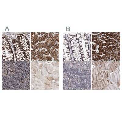 Immunohistochemistry-Paraffin: NADKD1 Antibody [NBP2-48680]