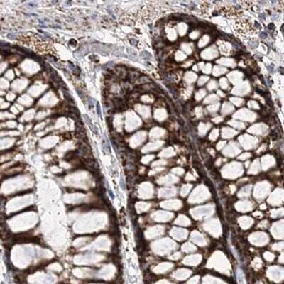 Immunohistochemistry-Paraffin: NADKD1 Antibody [NBP2-48680]