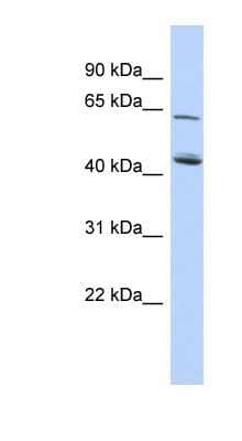 Western Blot: NADKD1 Antibody [NBP1-56734]