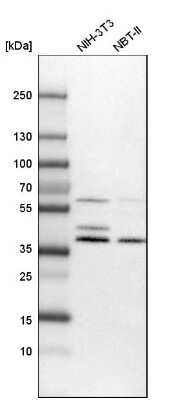 Western Blot: NADKD1 Antibody [NBP1-83547]