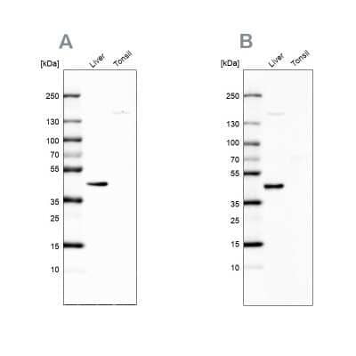 Western Blot: NADKD1 Antibody [NBP2-48680]