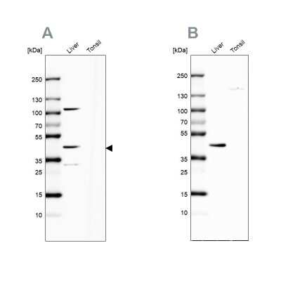 Western Blot: NADKD1 Antibody [NBP2-49337]