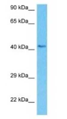 Western Blot: NADKD1 Antibody [NBP3-09313]