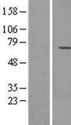 Western Blot: APPBP1 Overexpression Lysate [NBL1-13459]