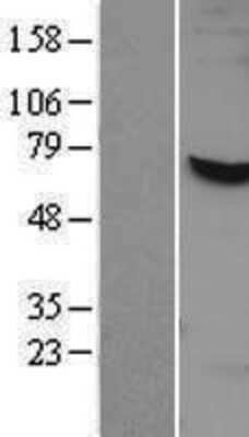 Western Blot: APPBP1 Overexpression Lysate [NBP2-09795]