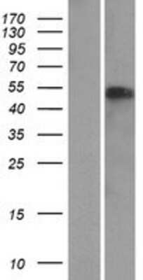 Western Blot: NAF1 Overexpression Lysate [NBP2-05666]