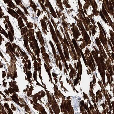 Immunohistochemistry-Paraffin: NAG Antibody [NBP1-92164]