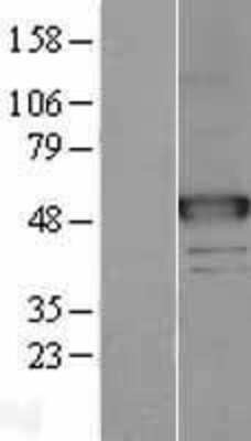 Western Blot: alpha-N-acetylgalactosaminidase/NAGA Overexpression Lysate [NBL1-13462]