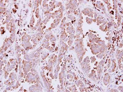 Immunohistochemistry-Paraffin: alpha-N-acetylglucosaminidase/NAGLU Antibody [NBP2-19465]