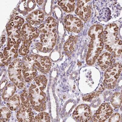 Immunohistochemistry: NAGPA Antibody [NBP2-38041]