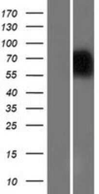 Western Blot: NAGPA Overexpression Lysate [NBP2-07064]