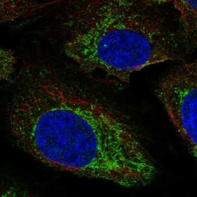 Immunocytochemistry/ Immunofluorescence: NAGS Antibody [NBP2-58283]