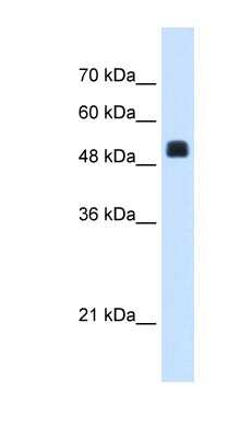 Western Blot: NAGS Antibody [NBP1-79444]