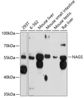 Western Blot: NAGS AntibodyAzide and BSA Free [NBP2-93763]