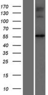 Western Blot: NAGS Overexpression Lysate [NBP2-05290]