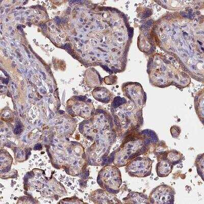 Immunohistochemistry: NAIP Antibody [NBP1-88596]