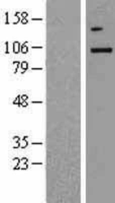 Western Blot: TBK1 Overexpression Lysate [NBP2-10346]