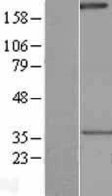 Western Blot: NLRP1/NALP1 Overexpression Lysate [NBL1-13671]