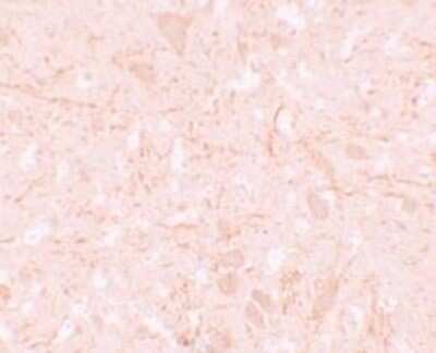 Immunohistochemistry-Paraffin: NALP12 Antibody - BSA Free [NBP1-76293]