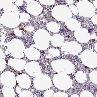 Immunohistochemistry-Paraffin: NALP12 Antibody [NBP1-85555]